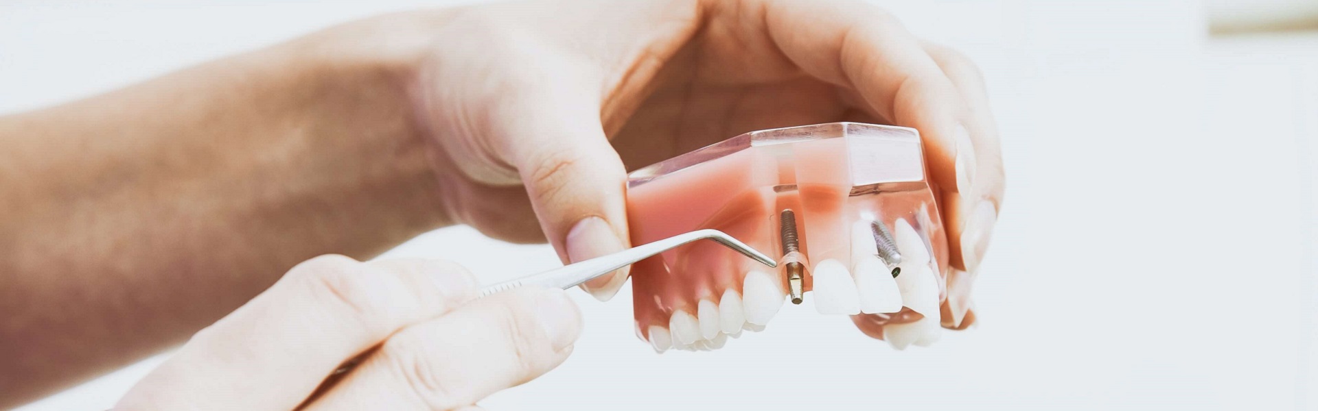 FIAT delovi | Zubni implanti Beograd